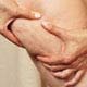 Cellulite Bühne Foto